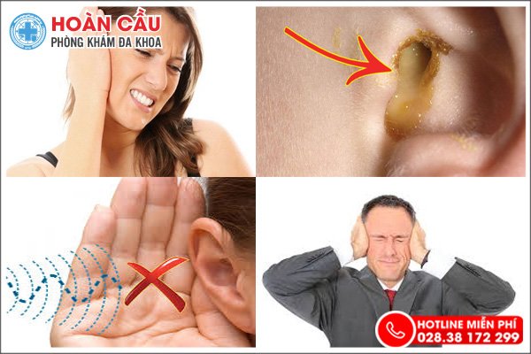 Tổng quan bệnh về tai cần hết sức lưu ý!
