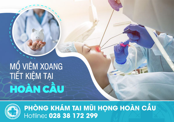 Chi phí mổ xoang là bao nhiêu? Xem bảng giá chi tiết hiện nay