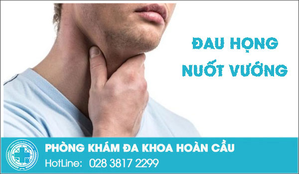 Đau họng nuốt vướng không hề đơn giản