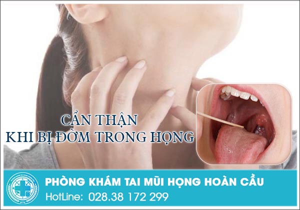 Đờm trong họng - cẩn thận với bệnh nguy hiểm