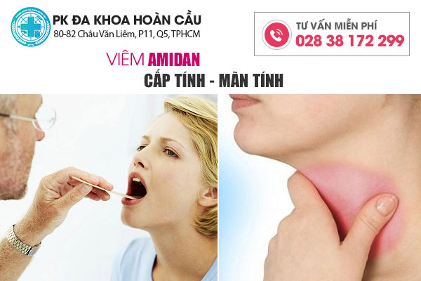 Hình ảnh bị viêm amidan