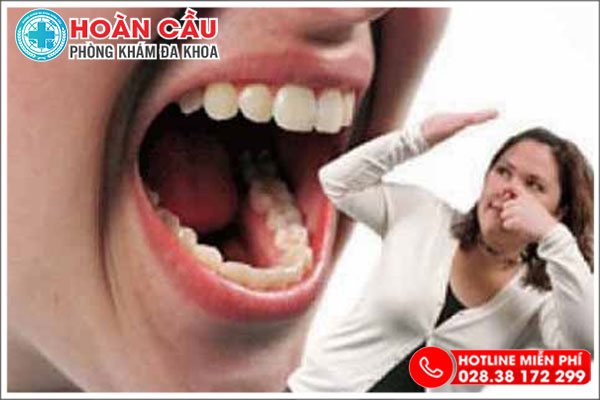 Hôi miệng từ cổ họng Nguyên nhân và cách điều trị đúng đắn