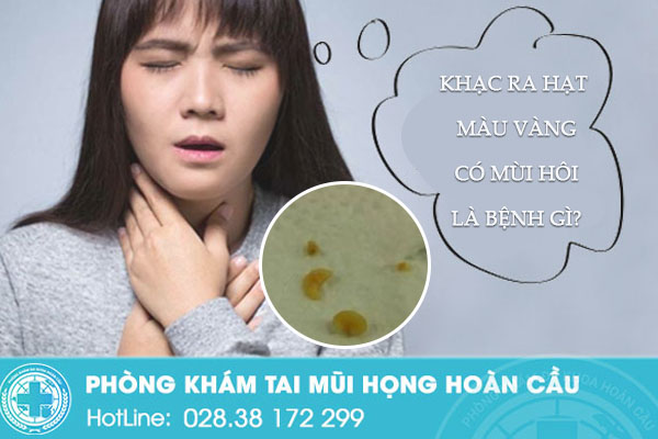 Khạc ra hạt màu vàng có mùi hôi là bệnh gì? tại sao lại bị mắc bệnh?