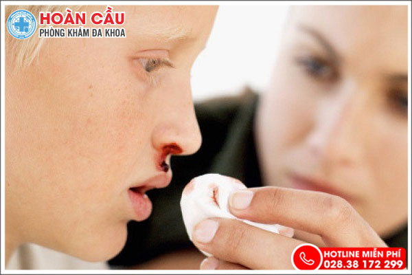 Lời cảnh báo: Chảy máu mũi bất thường là dấu hiệu bệnh lý nghiêm trọng