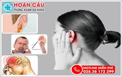 Nguy hiểm khôn lường từ hiện tượng đau nhức lỗ tai
