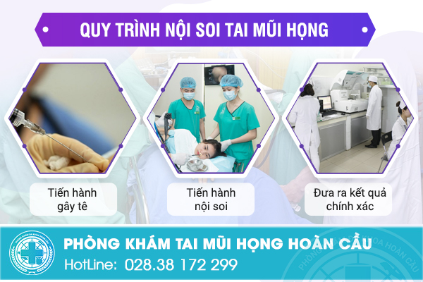 Giới thiệu kỹ thuật nội soi tai mũi họng an toàn chính xác không đau