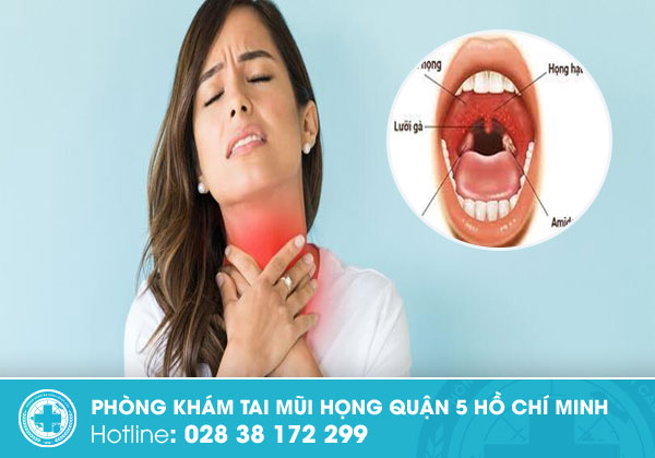 Sưng amidan nguy hiểm ra sao và làm gì để hết sưng?