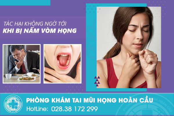 Nấm vòm họng là gì? có nguy hiểm không?