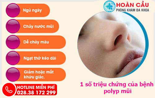 Triệu chứng và các giai đoạn phát triển của Polyp mũi