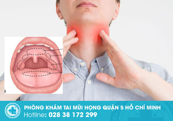 Triệu chứng viêm amidan nhận biết như thế nào để không nhầm lẫn