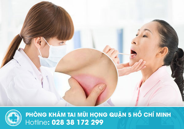 U vòm họng có chữa được không? và chi phí có cao không?