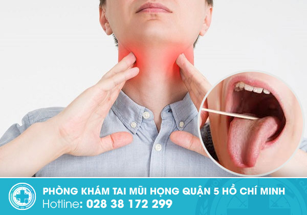 Viêm amidan mãn tính: Dấu hiệu và cách điều trị hiệu quả