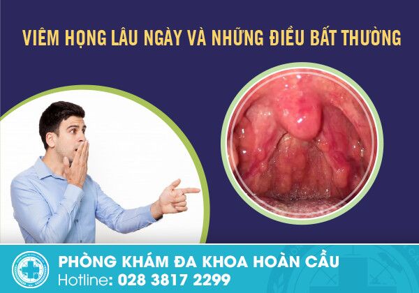 Viêm họng lâu ngày và những điều bất thường